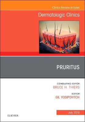 Pruritus, An Issue of Dermatologic Clinics by Gil Yosipovitch image