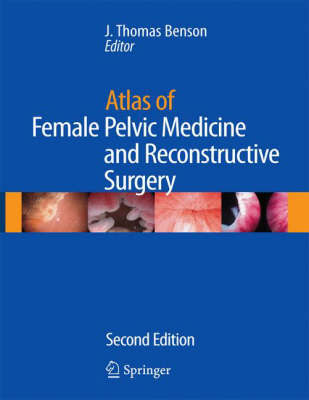 Atlas of Female Pelvic Medicine and Reconstructive Surgery by Benson image