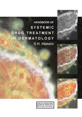 Systemic Drug Treatment in Dermatology: A Handbook on Paperback