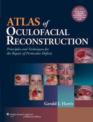 Atlas of Oculofacial Reconstruction on Hardback by Gerald J. Harris