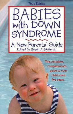 Babies with Down Syndrome image