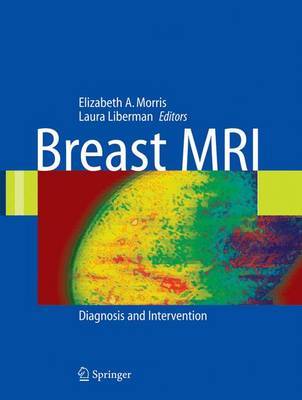 Breast MRI image
