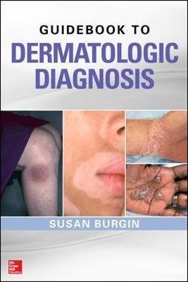 Guidebook to Dermatologic Diagnosis by Susan Burgin image