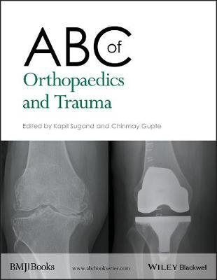 ABC of Orthopaedics and Trauma by Kapil Sugand image