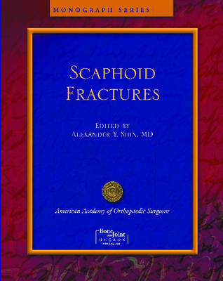 Scaphoid Fractures image