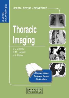 Thoracic Imaging: Self-Assessment Colour Review on Paperback by Sue Copley