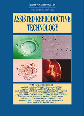 Assisted Reproductive Technology: A Reference Book on A.R.T. image