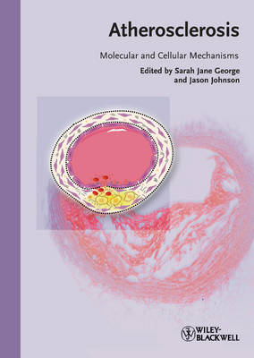 Atherosclerosis image