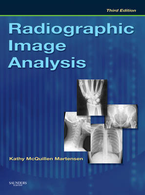 Radiographic Image Analysis by Kathy McQuillen Martensen image