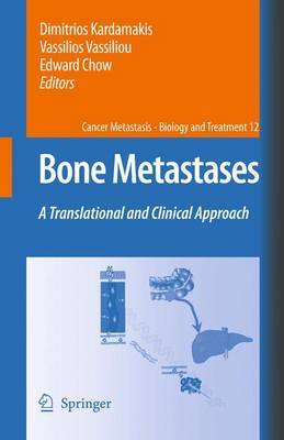 Bone Metastases image