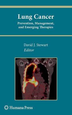 Lung Cancer: on Hardback