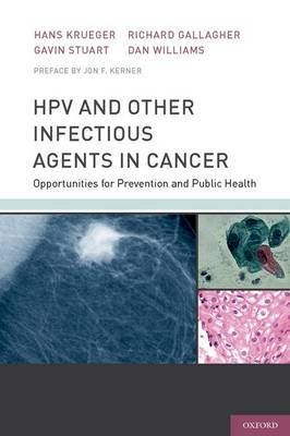 HPV and Other Infectious Agents in Cancer image