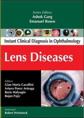 Lens Diseases by Arturo Perez Arteaga image