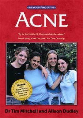 Acne by Tim Mitchell image
