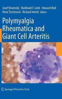 Polymyalgia Rheumatica and Giant Cell Arteritis image