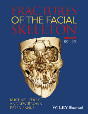 Fractures of the Facial Skeleton by Michael Perry image