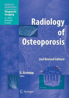 Radiology of Osteoporosis image