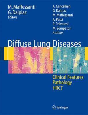 Diffuse Lung Diseases image