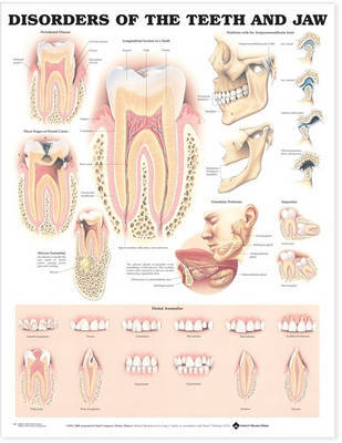 Disorders of the Teeth and Jaw Anatomical Chart image