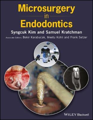 Microsurgery in Endodontics on Hardback