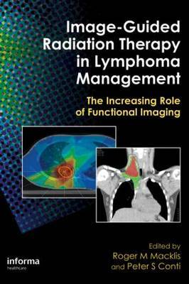 Image-Guided Radiation Therapy in Lymphoma Management on Hardback