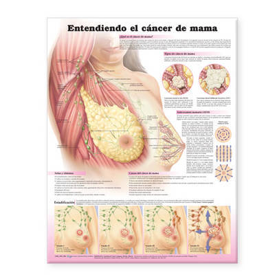 Understanding Breast Cancer Anatomical Chart in Spanish (Entendiendo El Cancer De Mama) image