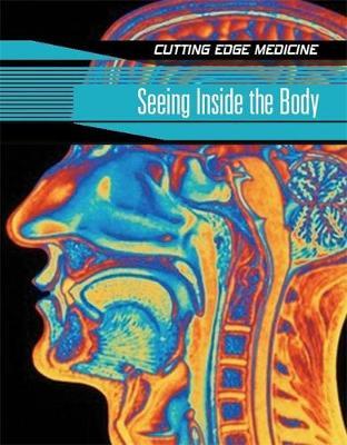 Seeing Inside The Body by Carol Ballard image