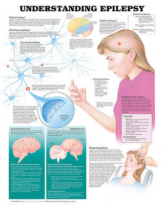 Understanding Epilepsy Anatomical Chart image