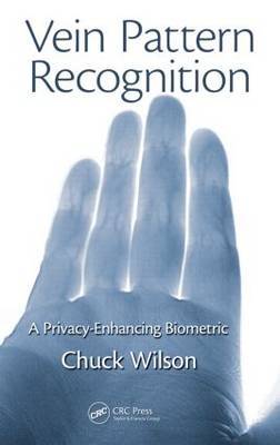 Vein Pattern Recognition image