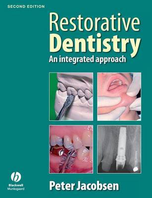 Restorative Dentistry by Peter Jacobsen image