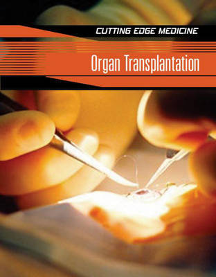 Organ Transplantation by Carol Ballard image