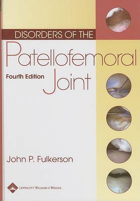 Disorders of the Patellofemoral Joint by John P. Fulkerson image