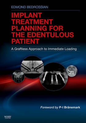 Implant Treatment Planning for the Edentulous Patient by Edmond Bedrossian image
