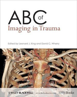 ABC of Imaging in Trauma image