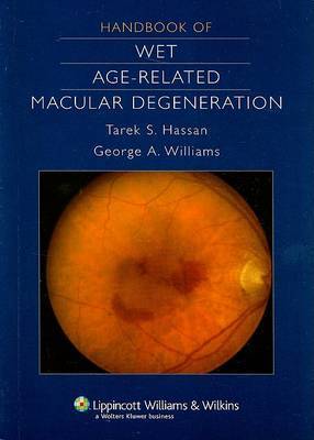 Handbook of Wet Age-Related Macular Degeneration by Tarek S Hassan image