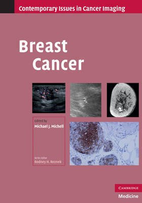 Breast Cancer image