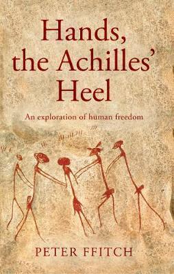 Hands, the Achilles' Heel by Peter Ffitch image