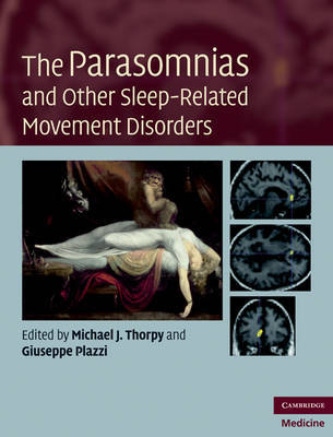 The Parasomnias and Other Sleep-Related Movement Disorders image