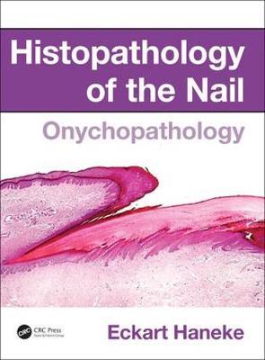 Histopathology of the Nail by Eckart Haneke image