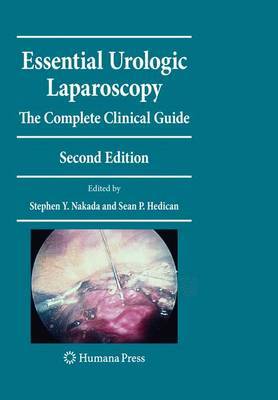 Essential Urologic Laparoscopy: The Complete Clinical Guide image