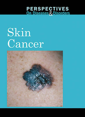 Skin Cancer image