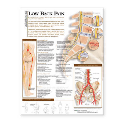 Understanding Low Back Pain Anatomical Chart image
