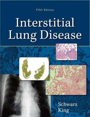 Interstitial Lung Disease on Hardback by Talmadge E. King, MD., Jr.