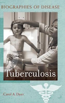 Tuberculosis image