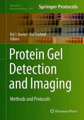 Protein Gel Detection and Imaging image
