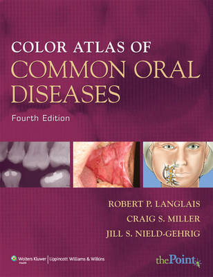 Color Atlas of Common Oral Diseases by Robert P. Langlais image