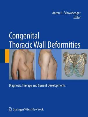 Congenital Thoracic Wall Deformities image