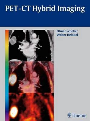 PET-CT Hybrid Imaging by Otmar Schober image