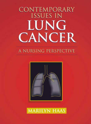 Contemporary Issues in Lung Cancer by Marilyn Haas image