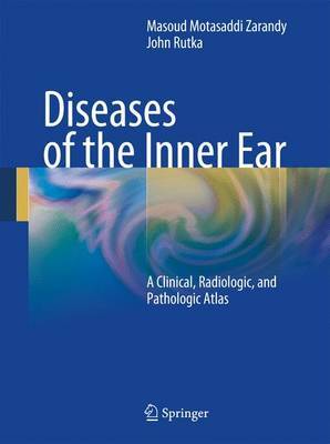 Diseases of the Inner Ear image